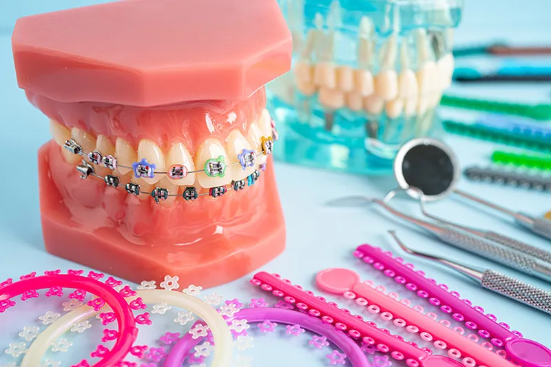 Orthodontic dental model with colorful braces surrounded by various braces bands and dental tools.