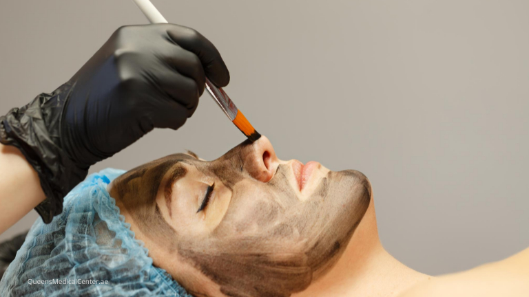 Queens Medical Center - carbon peel treatment Dubai