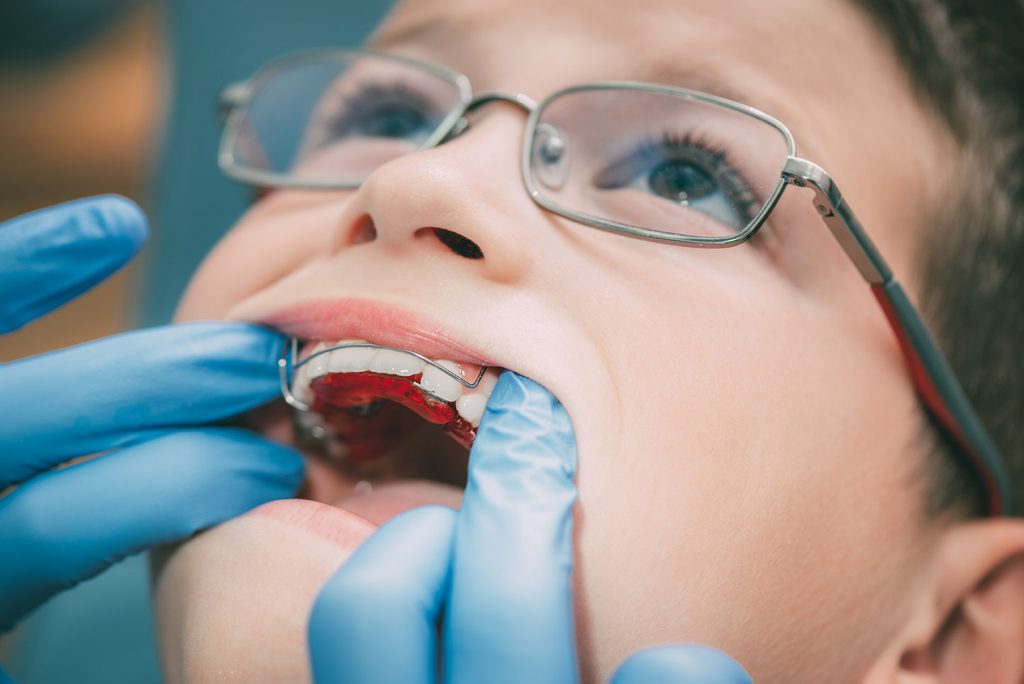 Child-friendly dental treatment room decorated with colorful artwork and cartoons, featuring a gentle pediatric dentist interacting with a young patient at Queens Medical Center Dubai