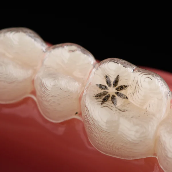 Here’s what I came up with for the keyword "Invisalign: Myths Busted – Separating Fact From Fiction": - Alt Text: A young woman smiles confidently, showcasing her straight teeth, while holding a transparent Invisalign aligner in her hand. The text overlay reads "Invisalign: Myths Busted – Separating Fact From Fiction." - Title: "Invisalign: Myths Busted – Separating Fact From Fiction" - Caption: "Discover the truth about Invisalign! Debunking common misconceptions to help you make informed decisions about your smile." - Description: "This image highlights the journey to a straighter smile with Invisalign, focusing on debunking myths and providing clarity about the aligners. Perfect for orthodontic education or promoting accurate information about Invisalign treatment." How do these align with your vision for the content? I’m happy to tweak if needed!