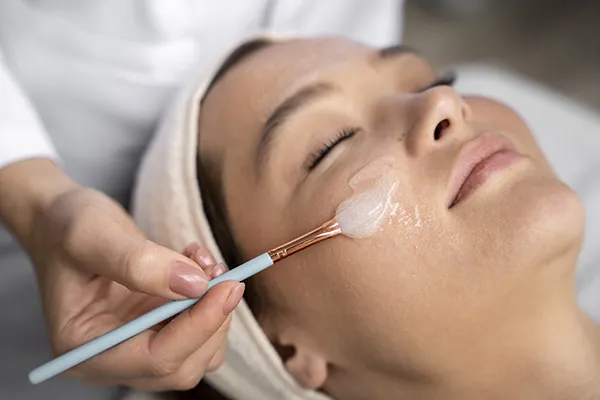 A chemical peel treatment being applied to exfoliate the outer layer of the skin for rejuvenation.